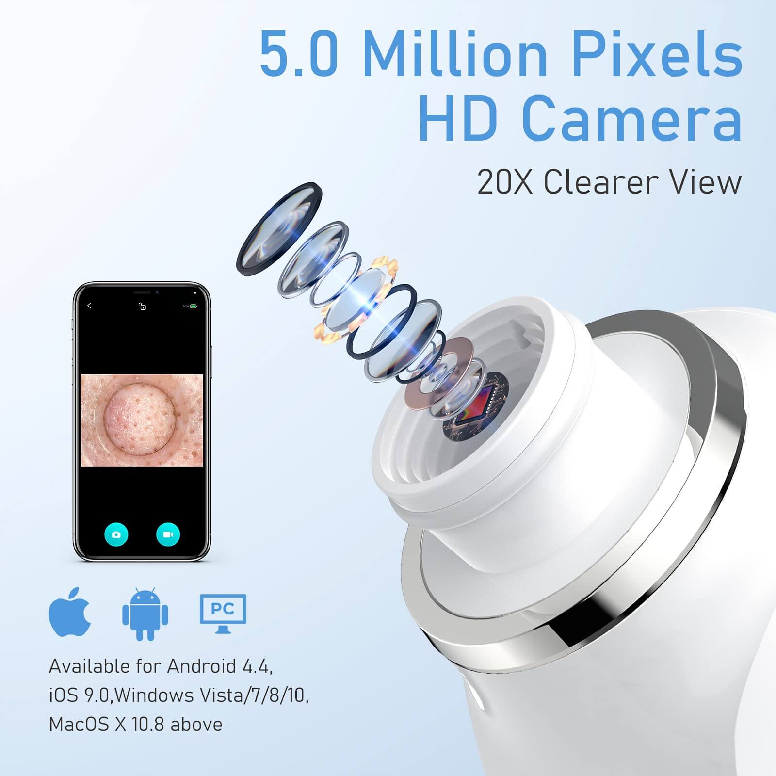 Visual Blackhead Remover Vacuum with HD Camera - Image 6