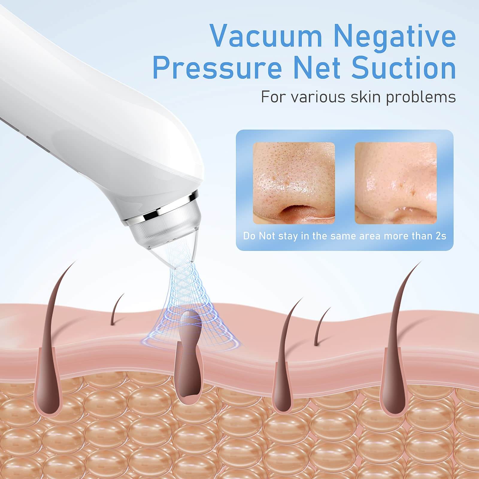 Visual Blackhead Remover Vacuum with HD Camera - Image 4